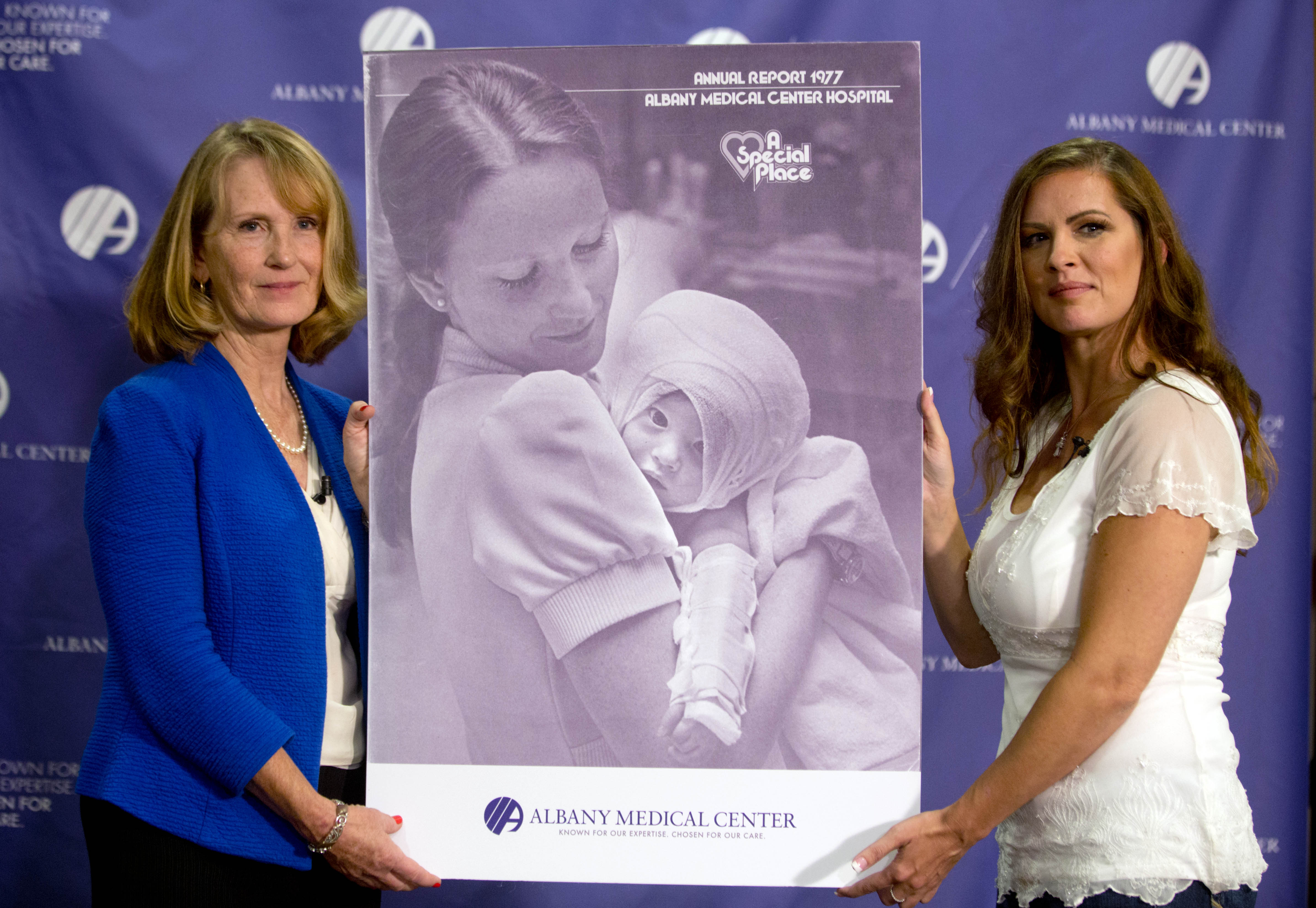 Nurse Susan Berger, left, and Amanda Scarpinati pose with a copy of a 1977 Albany Medical Center annual report during a news conference at Albany Medical Center, Tuesday, Sept. 29, 2015, in Albany, N.Y. Scarpinati, who suffered severe burns as an infant, is finally getting the chance to thank Berger who cared for her, thanks to a social media posting that revealed the identity of the nurse in 38-year-old photos. (AP Photo/Mike Groll)
