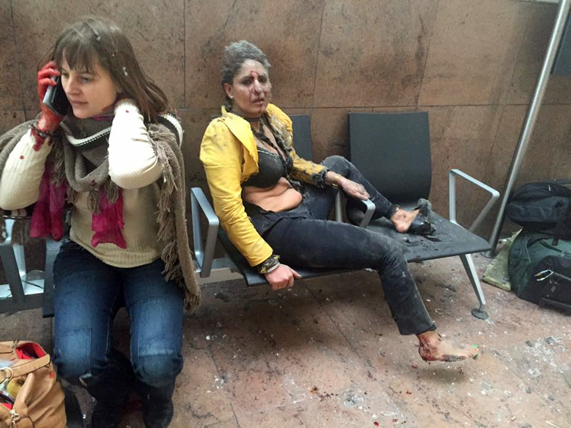 In this photo provided by Georgian Public Broadcaster and photographed by Ketevan Kardava, Nidhi Chaphekar, a 40-year-old Jet Airways flight attendant from Mumbai, right, and another unidentified woman after being wounded in Brussels Airport in Brussels, Belgium, after explosions were heard Tuesday, March 22, 2016. A developing situation left at least one person and possibly more dead in explosions that ripped through the departure hall at Brussels airport Tuesday, police said. All flights were canceled, arriving planes were being diverted and Belgium's terror alert level was raised to maximum, officials said. (Ketevan Kardava/ Georgian Public Broadcaster via AP)